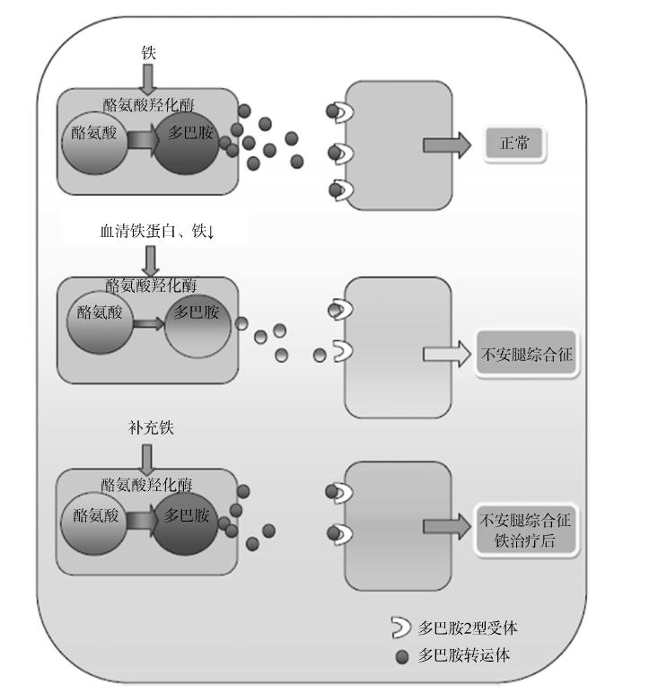 不宁腿综合征缺铁吗,不安腿综合征和缺铁有关系吗