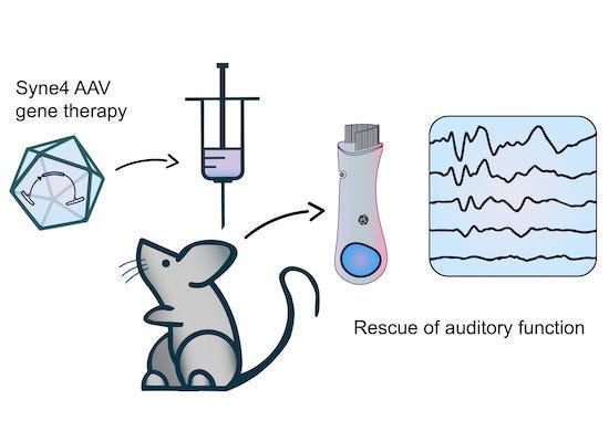 最新耳聋基因治疗人体实验,基因疗法治遗传性听力最新消息