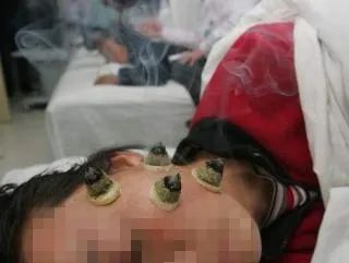 江苏省人民医院面瘫专病门诊,专病门诊有专家吗