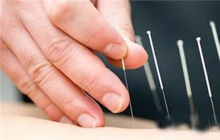 江苏省人民医院面瘫专病门诊,专病门诊有专家吗