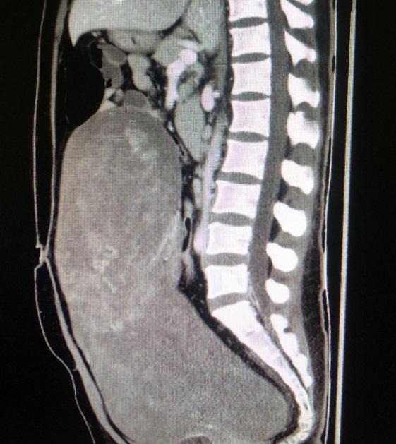 拆弹专家做手术,拆弹专家手术