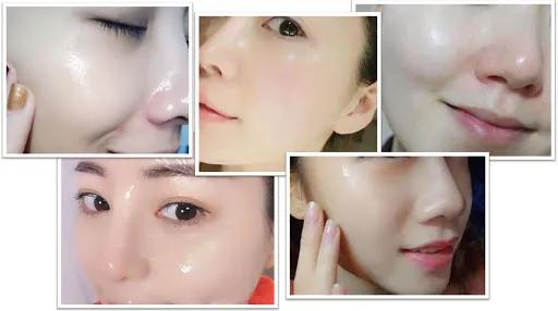 花了3万做激光，才彻底懂了：医生为什么劝你别去斑