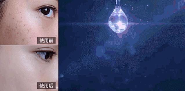 花了3万做激光，才彻底懂了：医生为什么劝你别去斑