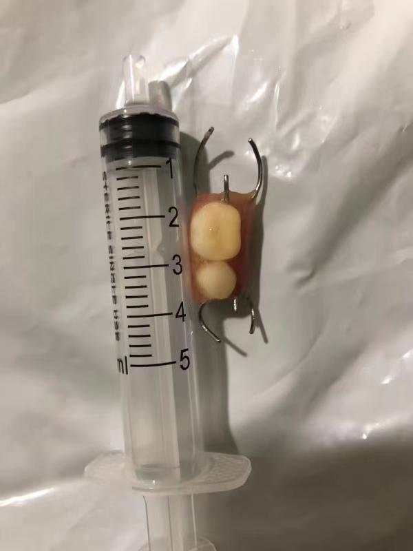假牙铁丝钩不谨慎吞下怎么办,不谨慎把假牙戴钩子吞了怎么办