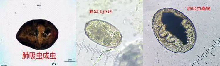 野外洞穴探险肺部感染,野外旅游被虫叮咬怎么办