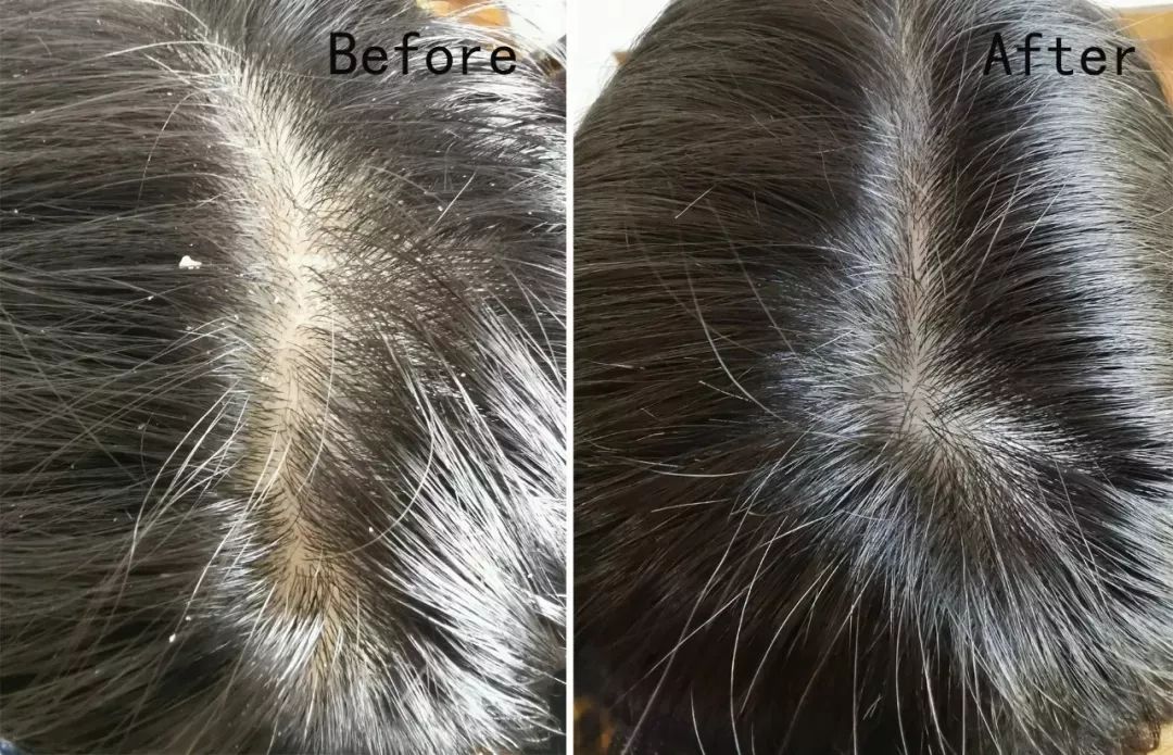 4周瘦20斤食谱,4周瘦30斤高效减脂餐