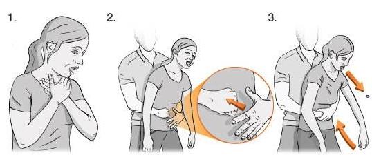 老人卡异物的急救方法,老人卡喉怎么急救