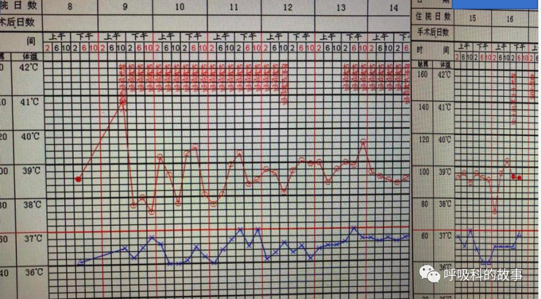 痰液培养阳性是否一定要用抗菌素？——为什么临床微生物学思维很重要（2）