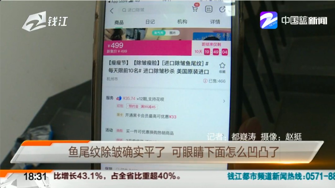 注射祛鱼尾纹,打鱼尾纹祛皱针后下眼睑皱纹变多