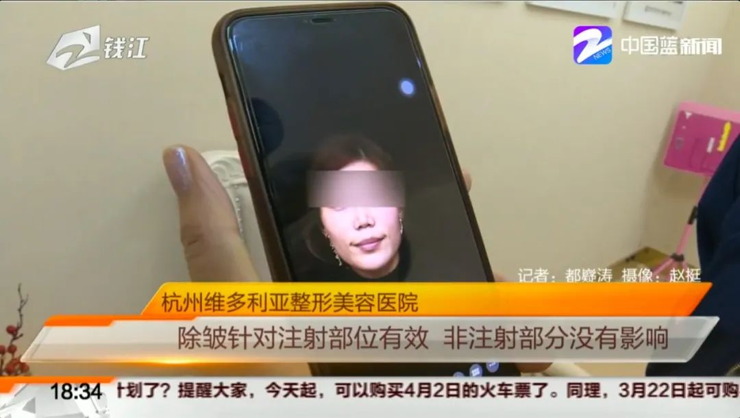 注射祛鱼尾纹,打鱼尾纹祛皱针后下眼睑皱纹变多