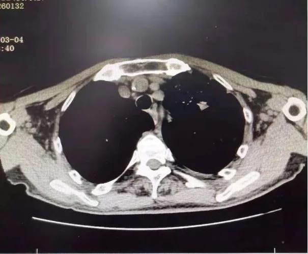 西安市胸科医院呼吸科专家,西安市胸科医院呼吸与危重症医学