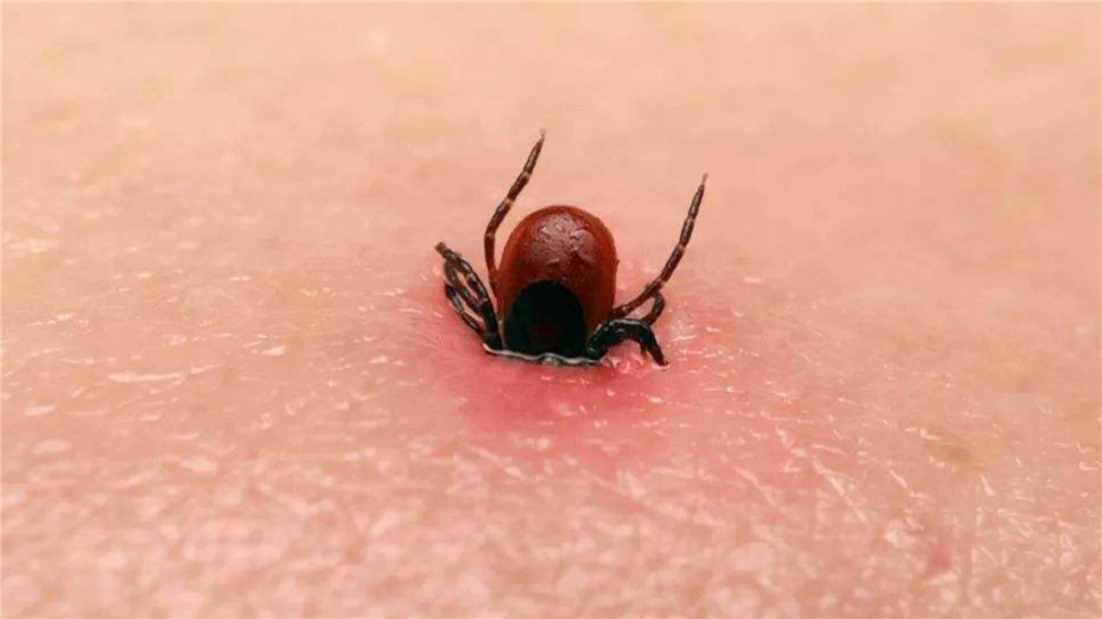 蜱虫疾病高发期省医院专家：被咬要尽快就医