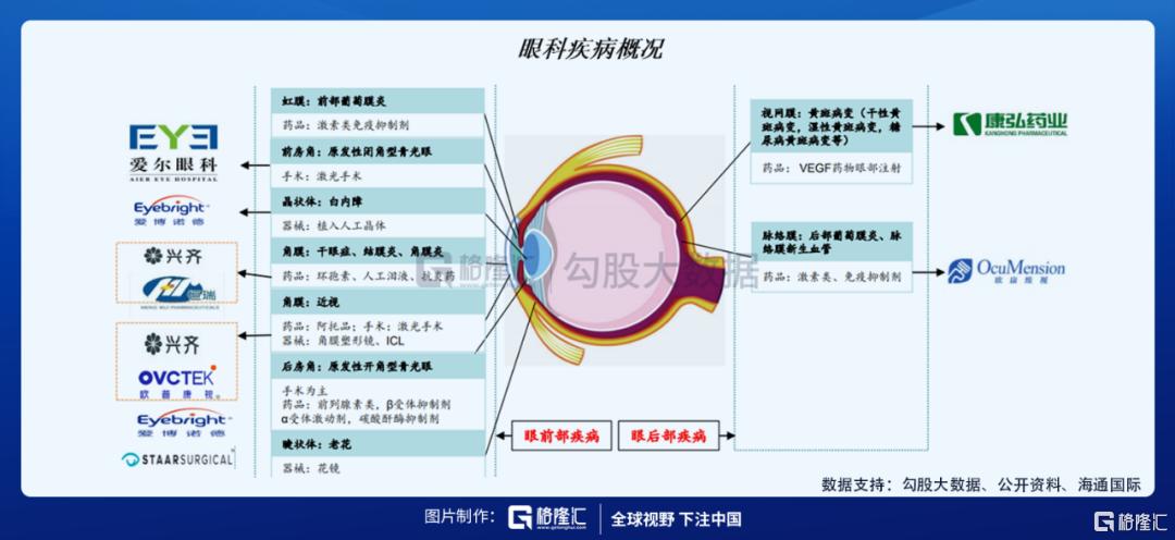 近视的人越来越多了，眼科公司纷纷上市，哪些公司值得多看一眼？