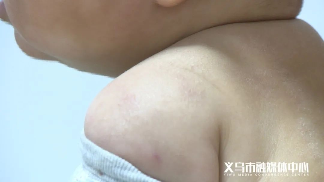 义乌本土感染情况,浙江义乌现在病情怎么样