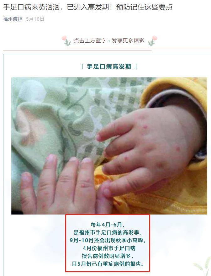 小孩发烧无症状查血说是病毒感染,手足口病发烧了但没有长疱疹