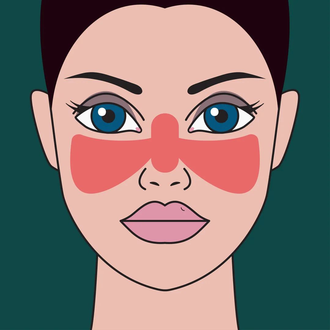 换季皮肤过敏泛红发痒小妙招,换季皮肤过敏最快解决方法