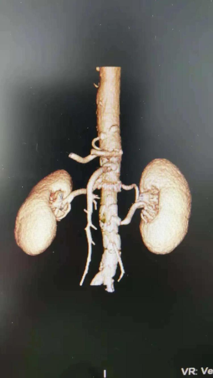 精准治疗高龄患者,精准医疗的治疗方式有哪些