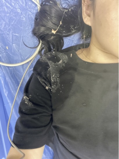 喜茶出事！店员错把陈列道具当饮料，顾客喝下后入院洗胃！回应来了