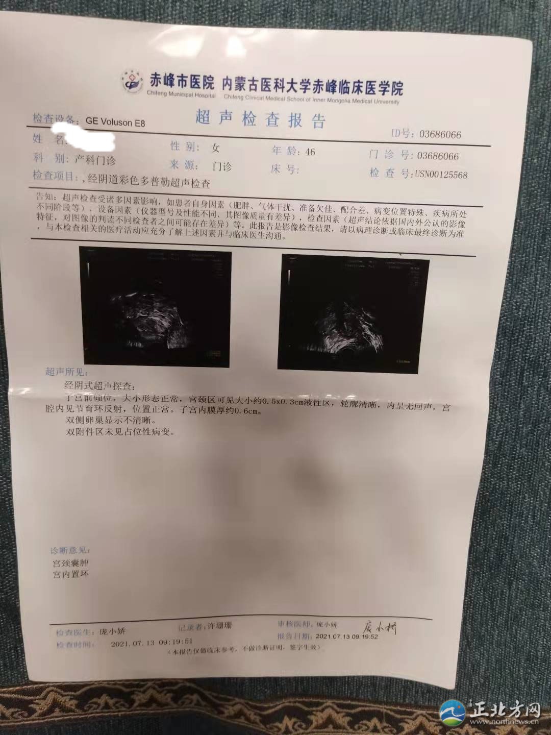 郭女士取环手术半年后环还在，记者采访被报警……