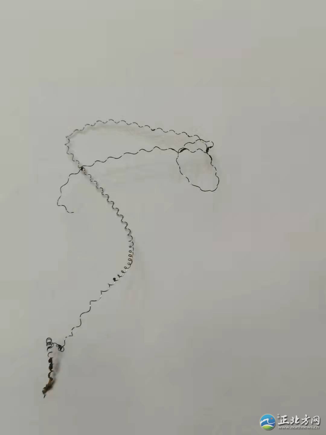 郭女士取环手术半年后环还在，记者采访被报警……