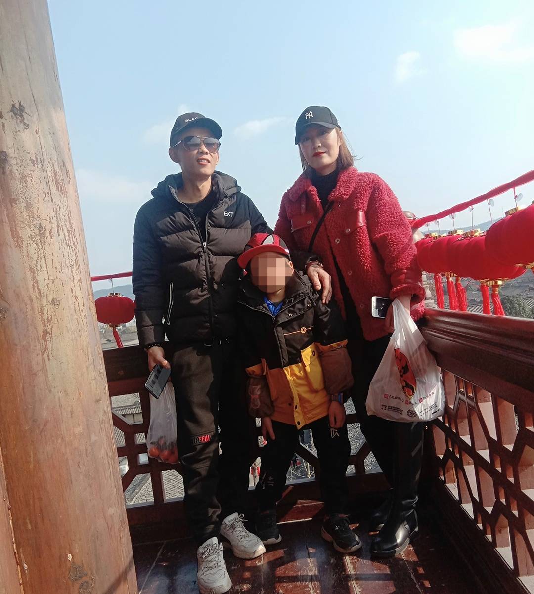 小男孩得神经纤维瘤,男孩不幸患上神经纤维瘤