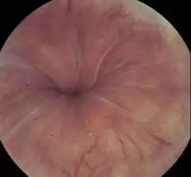 体检最难受的项目是哪几个,体检十大问题及解决方法