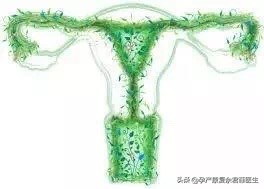 反复感染阴道炎，原因是这个