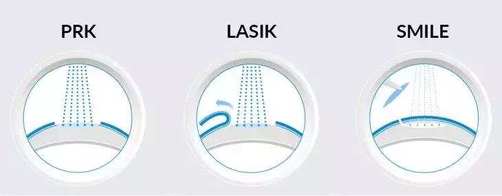 “近视手术毁了我”，他们选择自杀，原来这种手术比想象的危险！