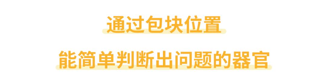 躺下摸到肚子里有个硬疙瘩,肚子摸起来硬硬的会有肿瘤