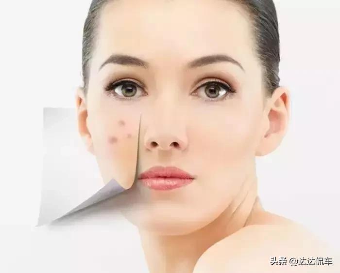 把花露水倒到手机上会怎么样,花露水不谨慎喷到手机上会怎样