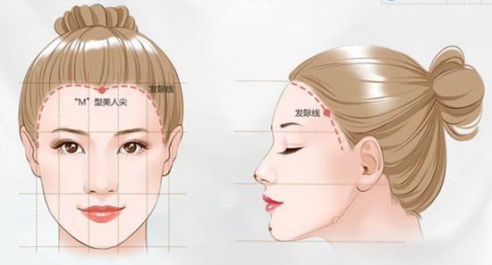 发际线高怎么办最快最有效,发际线高怎么办女孩