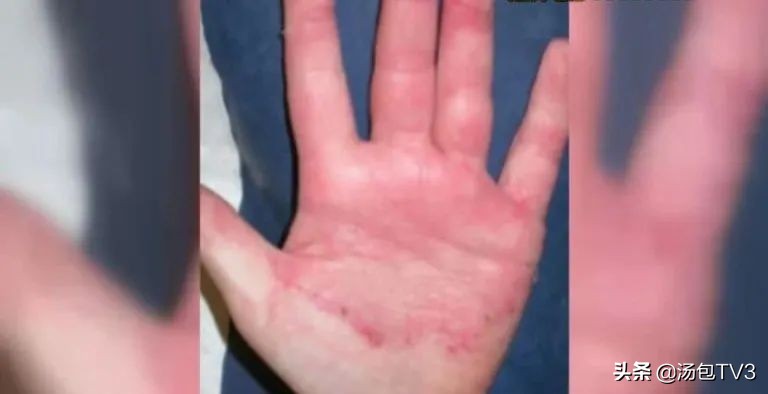 撸猫容易得什么病,经常撸猫容易得什么病