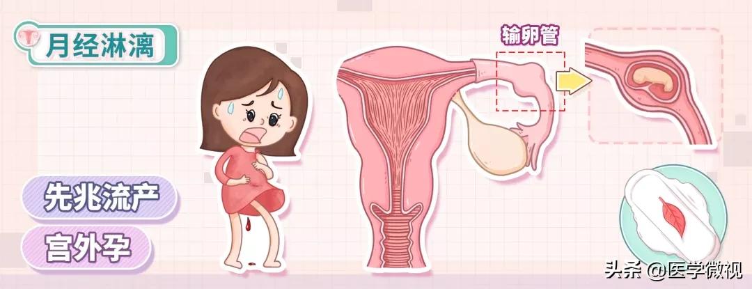 月经是暗红色是怎么回事,月经推迟并且是鲜红色是怎么回事