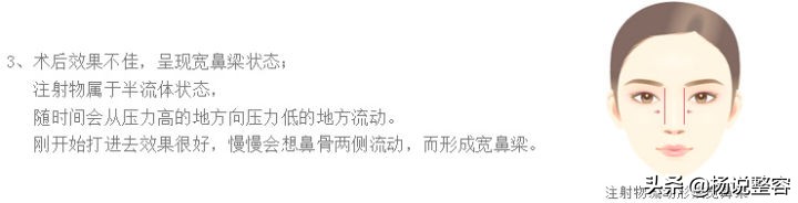隆鼻失败修复的几点建议,隆鼻失败医生会马上为患者修复吗