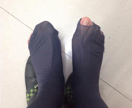 用prp治疗膝关节炎有消炎作用吗,骨关节炎打了prp后能管多久