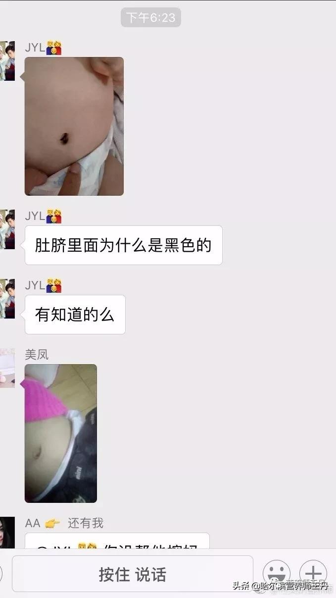 宝宝肚脐特别黑需要清理吗,宝宝肚脐黑有坑怎么回事