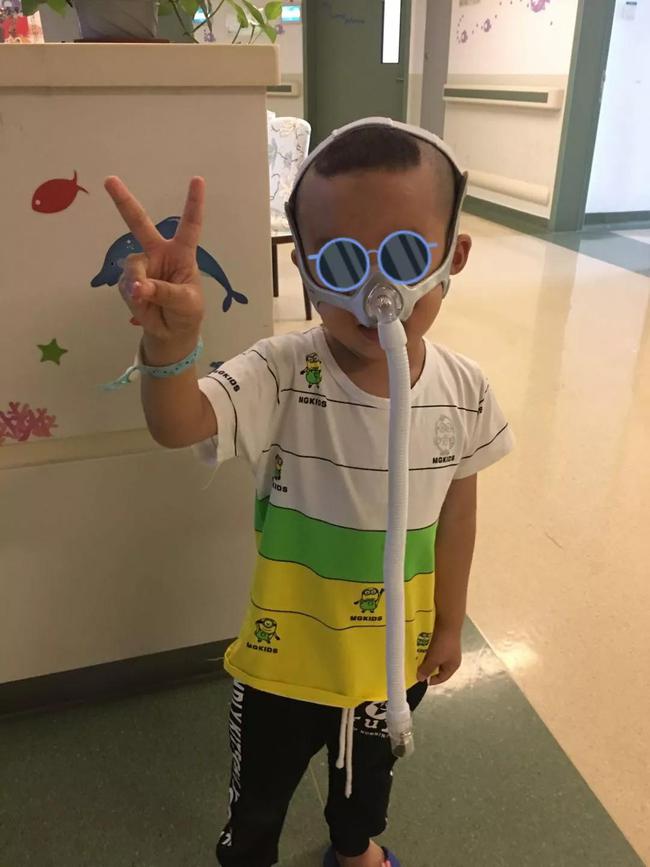 无创呼吸机辅助通气禁忌,什么样的宝宝不适合推拿