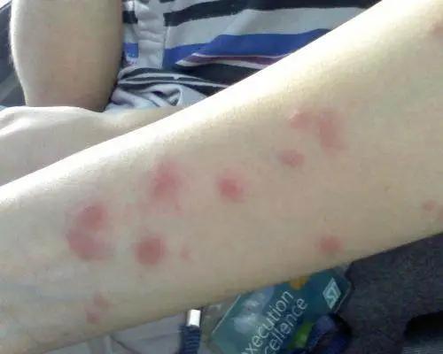 用什么方法灭蚊子最管用,灭蚊子的土方法