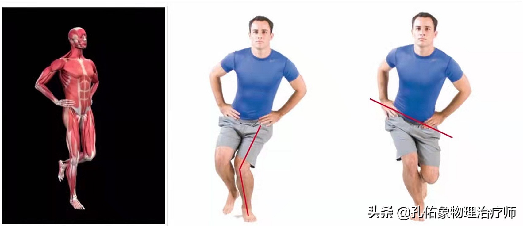 膝关节为什么疼,膝关节疼痛怎么治疗最好最有效