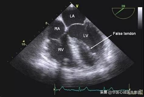 鍗庡尰蹇冭瘹鍖荤敓闆嗗洟鏈夐檺鍏徃,鍗庡尰蹇冭瘹鍖荤敓鐜扮姸