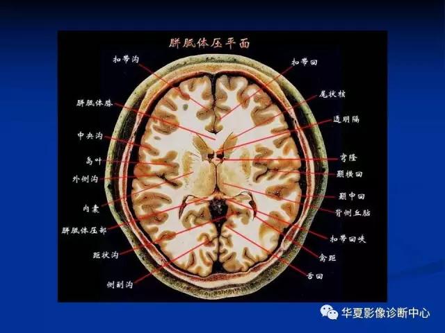 mra头颅解剖学详细讲解视频,常见的头颅mri图像