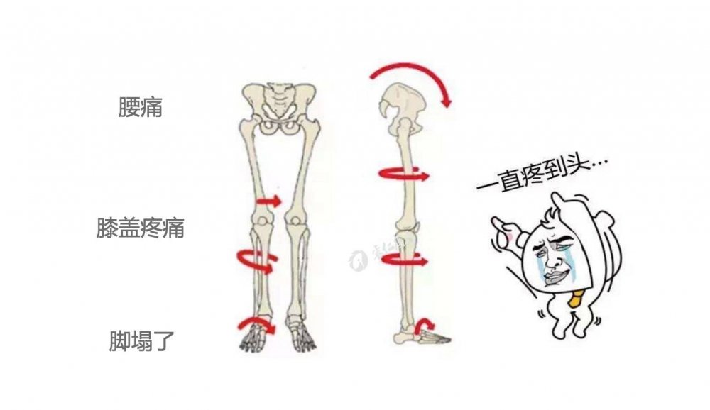 扁平足穿什么鞋都痛吗,扁平足穿什么鞋可以矫正