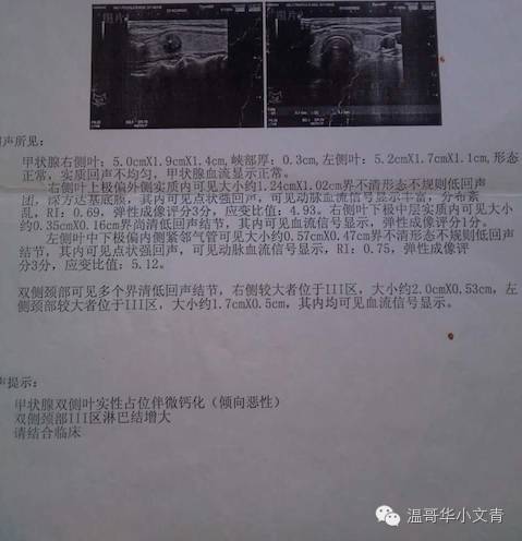 甲状腺癌存在过度治疗,被严重低估的甲状腺癌
