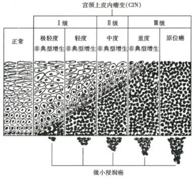 关于宫颈的那些谣言，你信过几个？——优秀科普作品展播