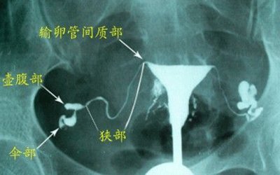 夫妻去医院检查不孕不育,男人检查不孕不育多少钱