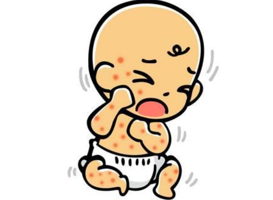 宝宝起疹子的症状有哪些,宝宝起疹子跟孕妈吃东西有关么