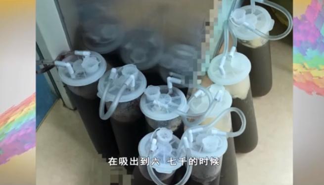 女子怀孕37周肚子巨大无比刨宫产取出25斤囊肿孩子只有5斤4两