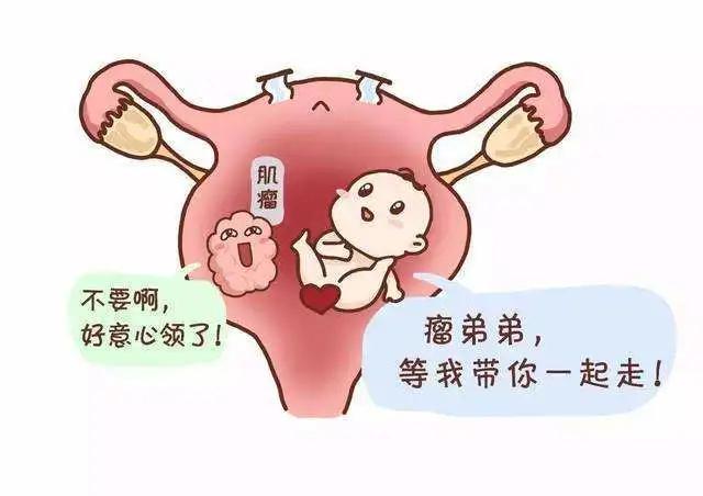 刚出生的婴儿身体里有个怪胎,单脐宝宝健康出生