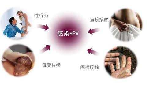hpv九价疫苗科普视频,关于HPV疫苗的科普