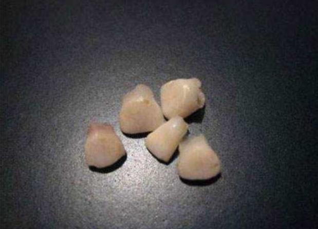 宝宝的乳牙掉了怎么处理,乳牙掉了不要扔关键时刻能救命